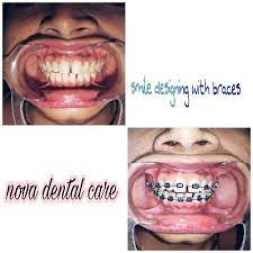 Nova Dental Care